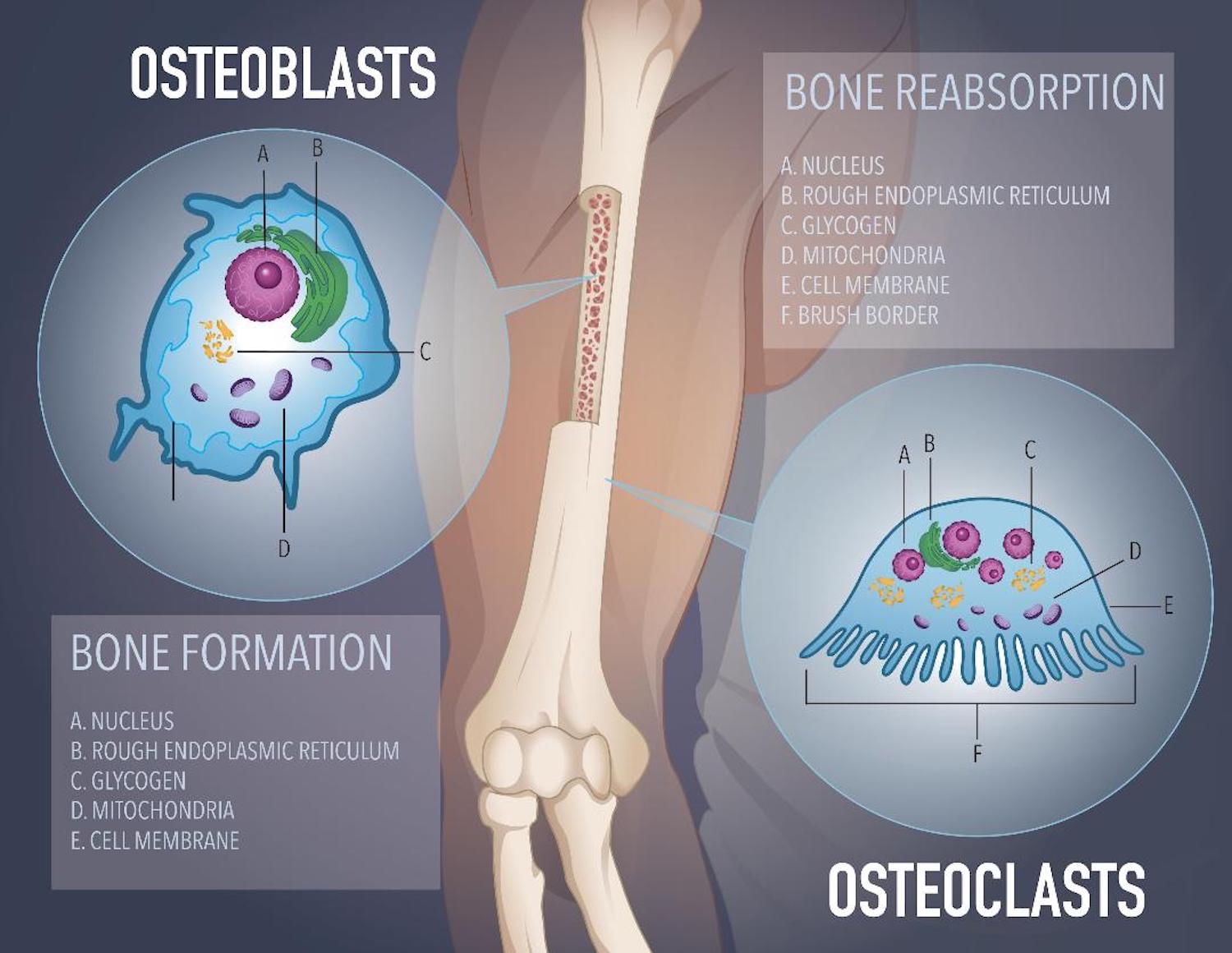 Osteoblasts vs. Osteoclasts