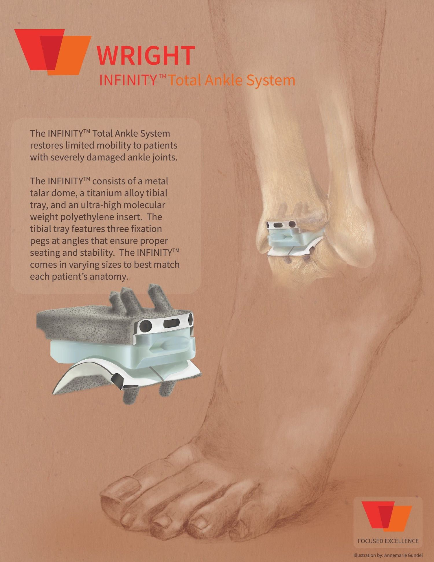 Ankle System